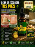 7 Days™ Tratamiento Antifúngico- Elimina la Micosis y Recupera tu Uña Sana