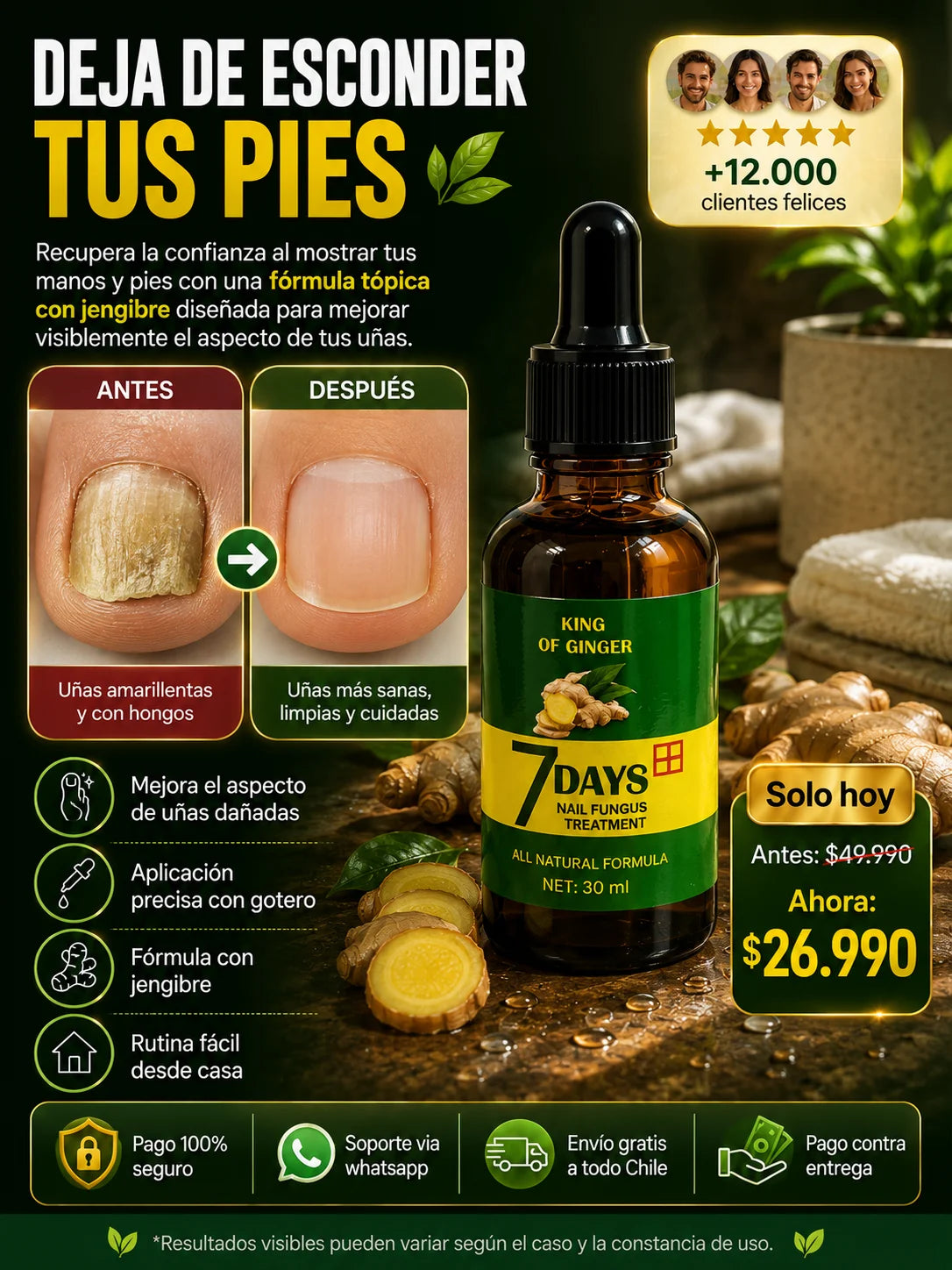 7 Days™ Tratamiento Antifúngico- Elimina la Micosis y Recupera tu Uña Sana