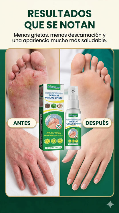 FungiClear™ 30ml: Lleva 2 y Paga 1-Pies sanos, suaves y sin picor.