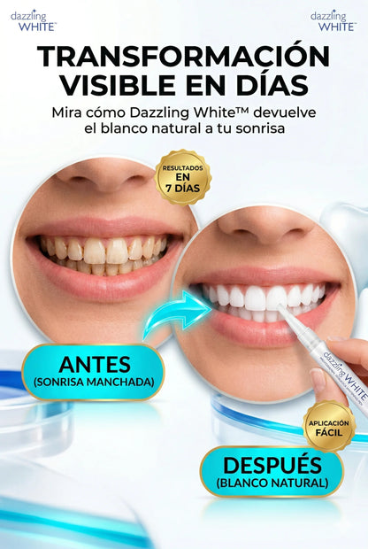 Lápiz Blanqueador Dazzling White™: Sonrisa de impacto en solo 7 días.