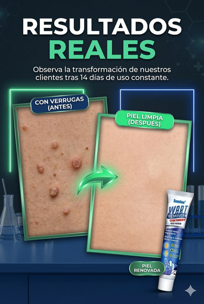 Crema WartRemover™Sumifun- Elimina y olvídate de las verrugas