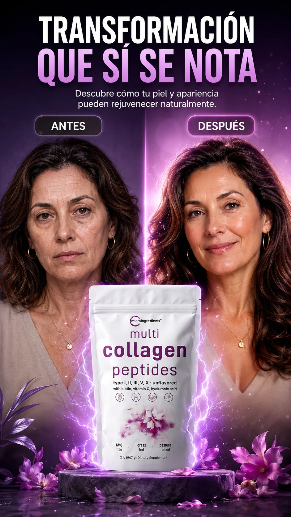 Collagen Peptides™ (450 grs): Piel radiante y articulaciones fuertes de inmediato.