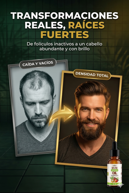Batana Oil™: Detén la caída y fortalece cada folículo.