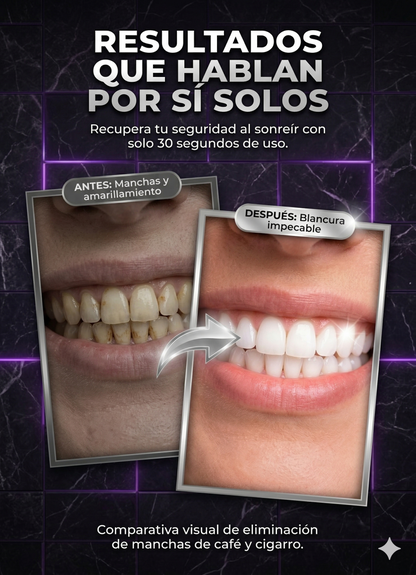 Pasta Dental Obsessive V34™: Tecnología correctora para una blancura impecable.