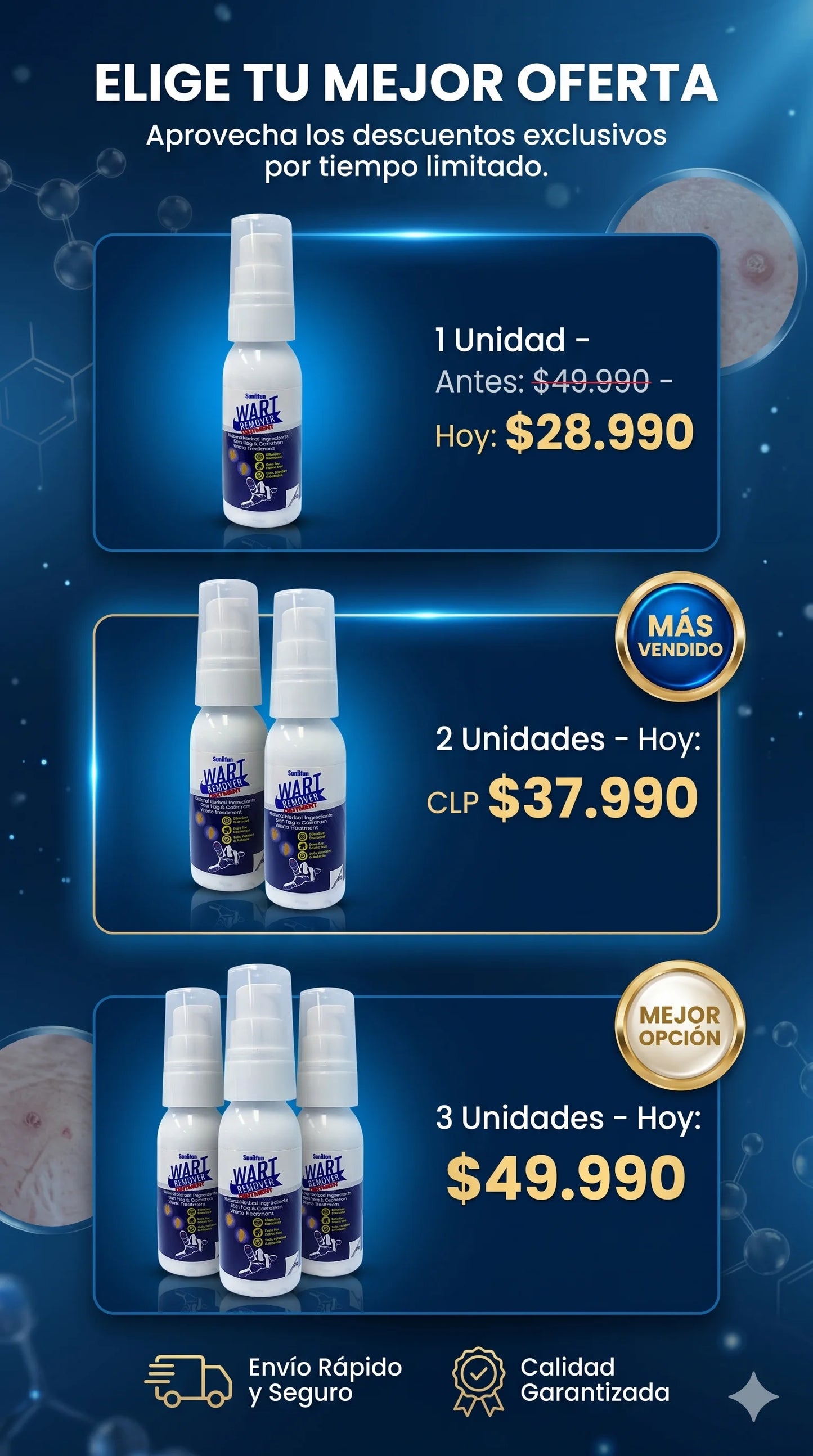 Wart Remover Spray™: Removedor de lunares y verrugas no deseadas