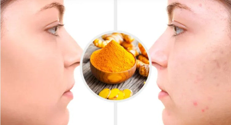 Jabón de cúrcuma natural  (Pack 2 unidades)