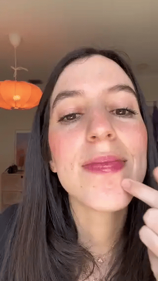 Acne patch result